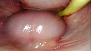 AMAZING INTERNAL POV. CAMERA INSIDE HER PUSSY WHILE I FILL HER WITH CUM