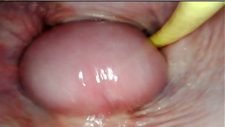 AMAZING INTERNAL POV. CAMERA INSIDE HER PUSSY WHILE I FILL HER WITH CUM
