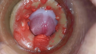 Camera Inside Deep Pussy Captures Huge Ejaculation of Sperm 4k